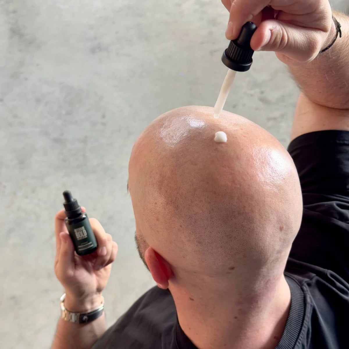 Midnight Recovery & Repair Bald Serum (0-6 mm.), 30 ml.