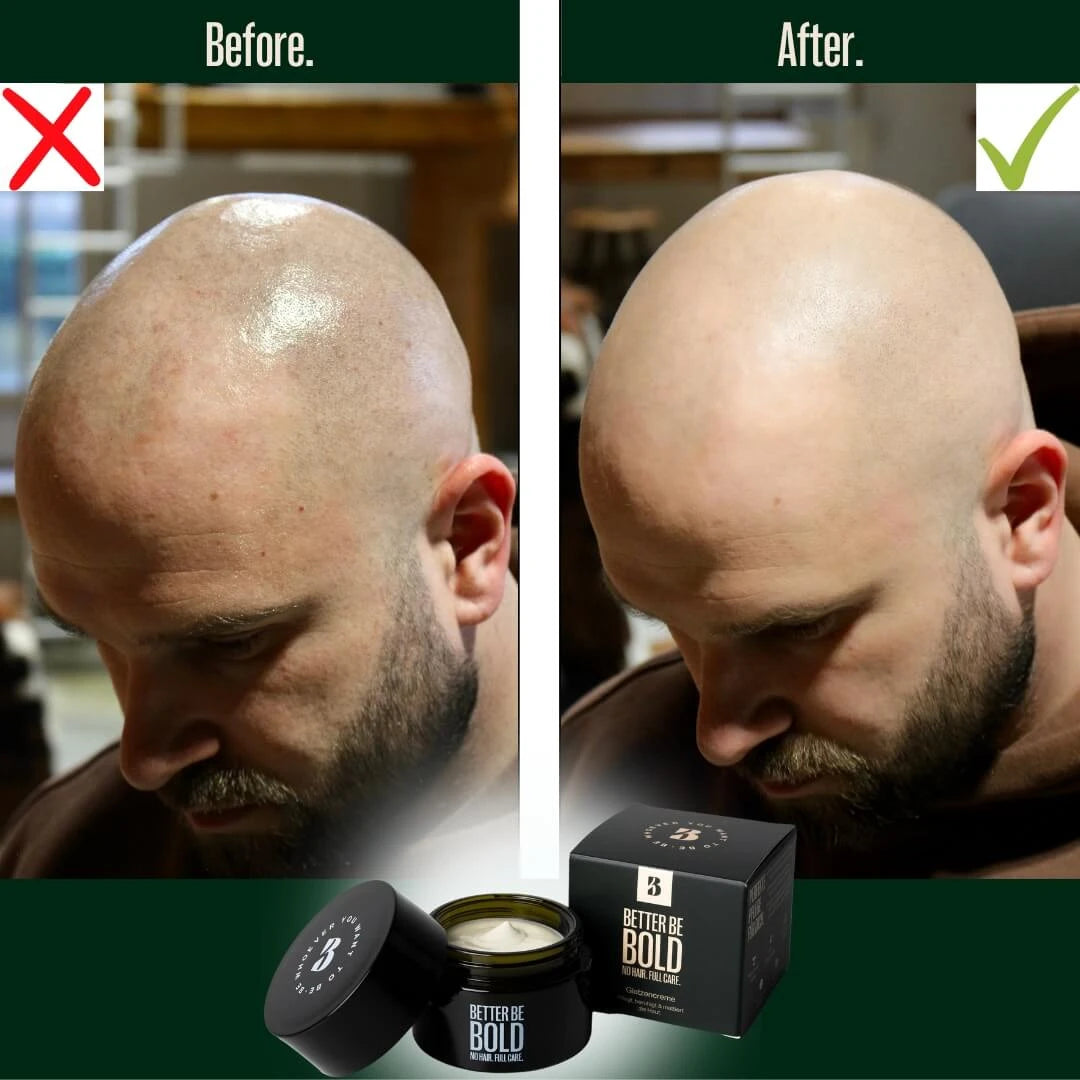 Återfuktande Bald Cream (0-3 mm.) - Matt Effect, 50 ml.