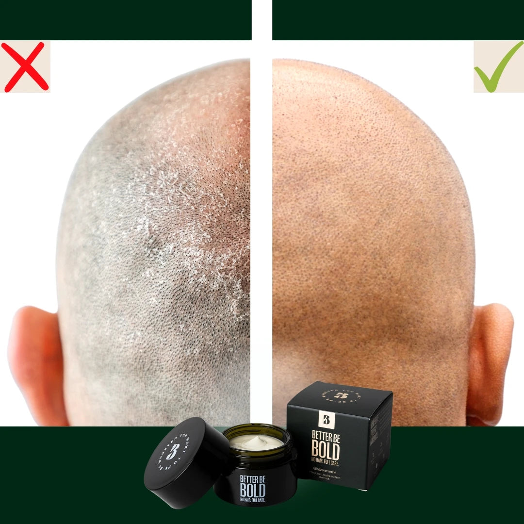 Återfuktande Bald Cream (0-3 mm.) - Matt Effect, 50 ml.