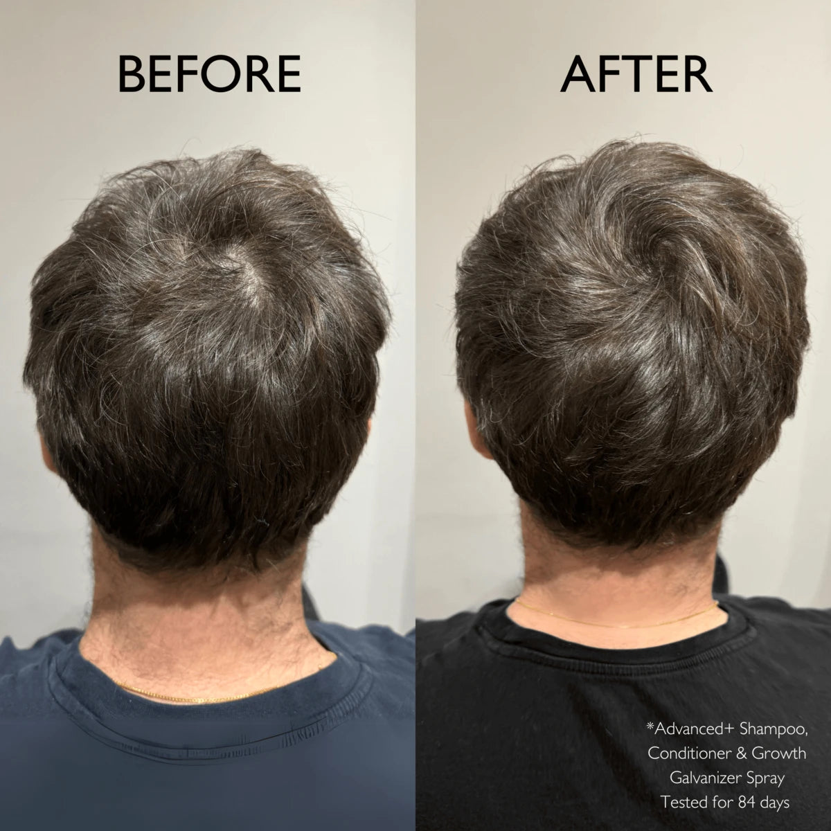 Advanced+ Hair Growth Galvaniser, 100 ml.