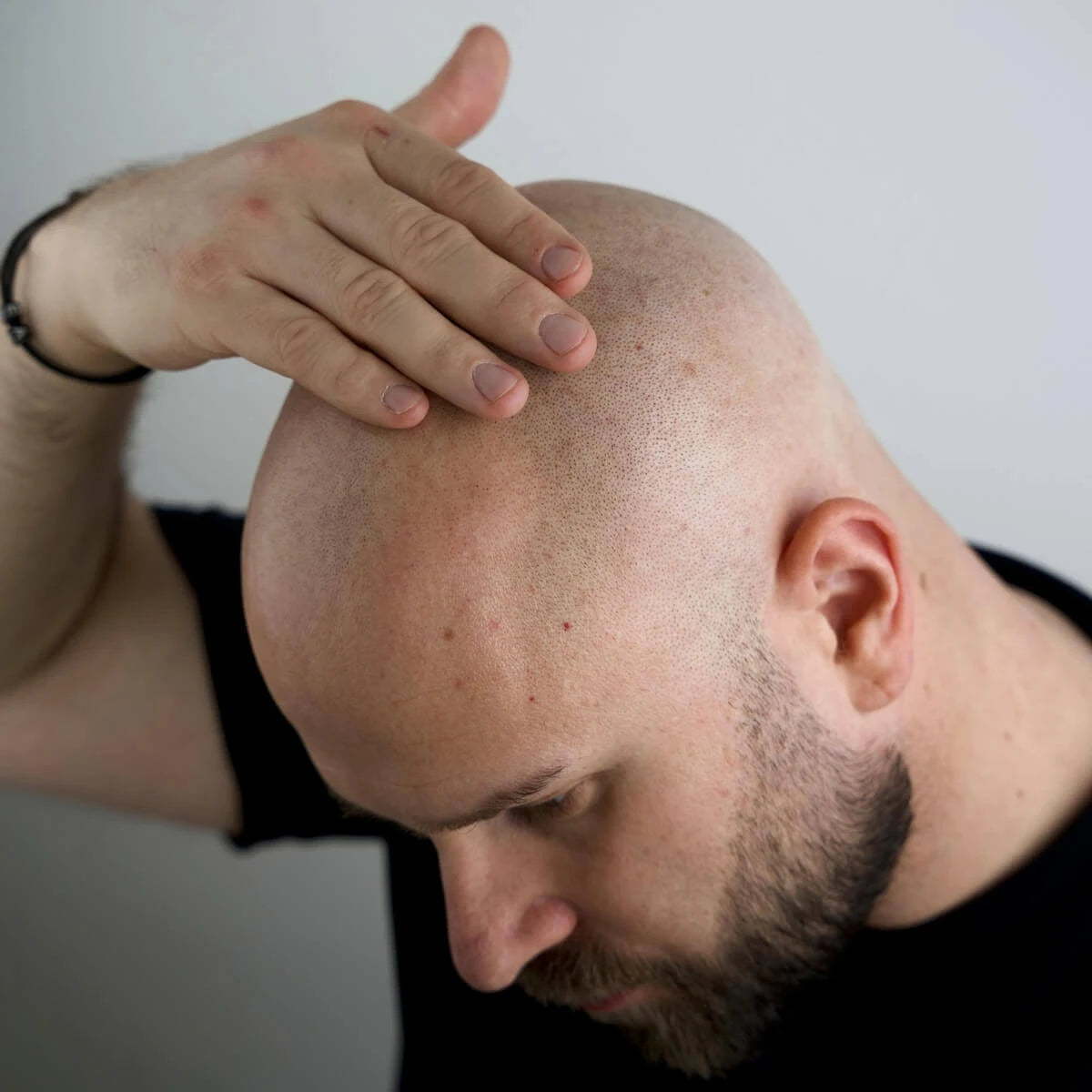 Magic Bald Head & Beard Oil, 30 ml.