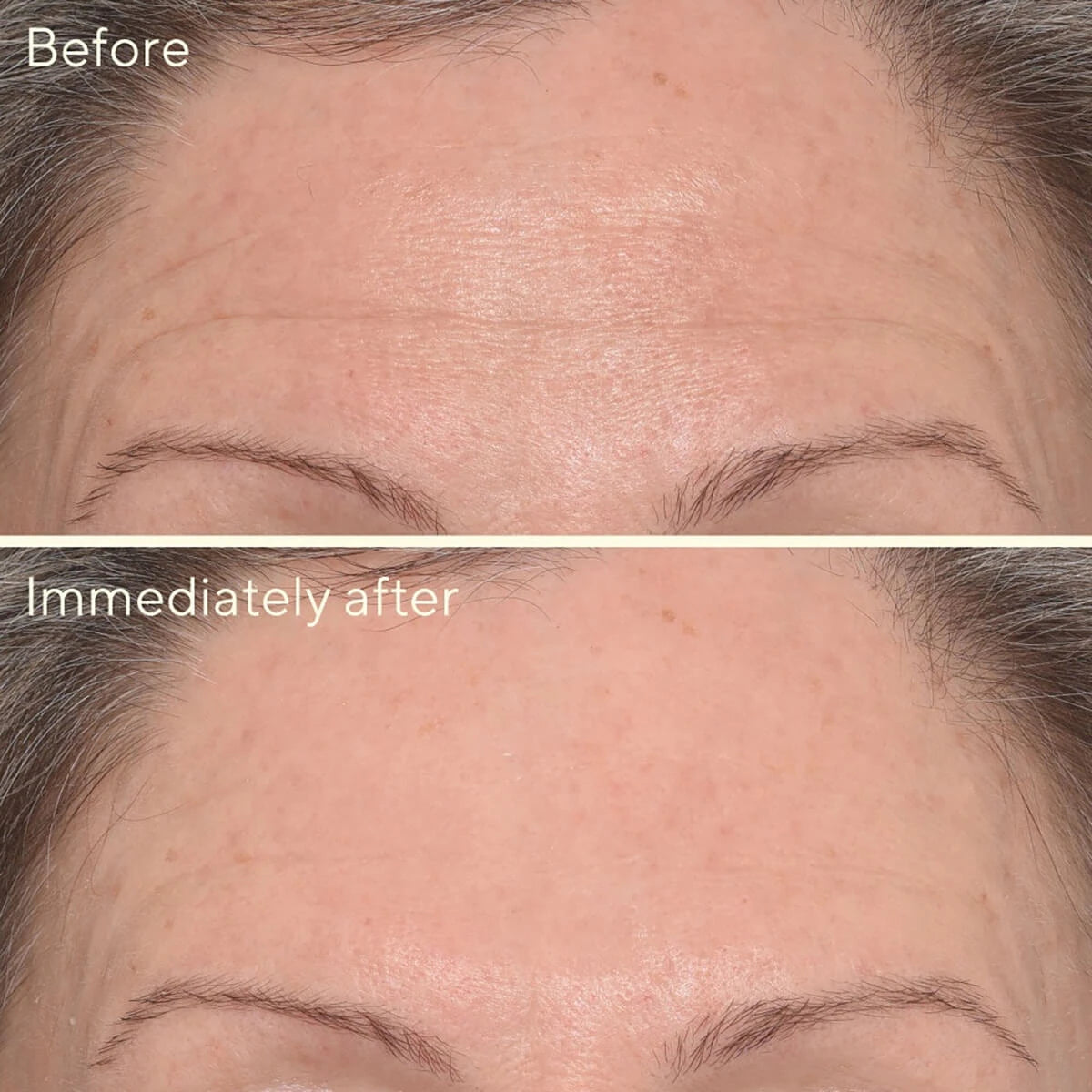 Targeted Wrinkle Corrector, Resurgence, 15 ml.